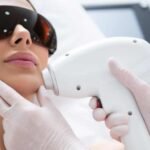 hair laser