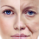 anti wrinkels